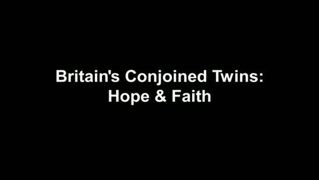 Cutting Edge   Britain's Conjoined Twins: Hope & Faith (19th February 2009) [PDTV (XviD)] preview 0