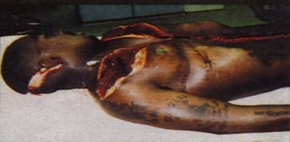 Tupac+autopsy+pics