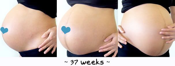 37 วีค แอนด์ baby head engaged