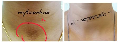 ป่องลอกคราบ แอนด์ ไอเดียเก๋กู้ด